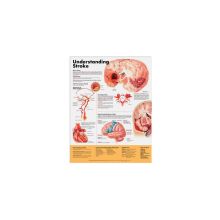 Anatomical Chart: Understanding Stroke